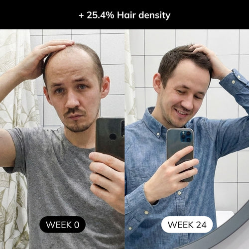 Peptide Based Hair Restore System